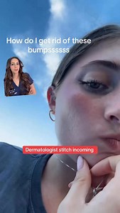 261K views · 546 reactions | bumpy skin & texture? I’ve got you 來‍⚕️ #dermatologist #skintok #skincare #acnetreatment #skintexture | Dr Aamna Adel | Facebook
