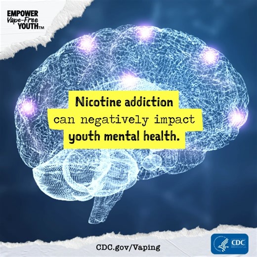 Nicotine withdrawal includes symptoms of anxiety, depression, irritability, sleep disturbance, and problems concentrating. Learn more: CDC.gov/Vaping | CDC Tobacco Free