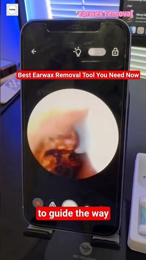 Best Earwax Removal Tool You Need Now