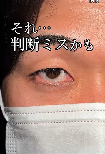 二重整形の魅力と新宿のTCB