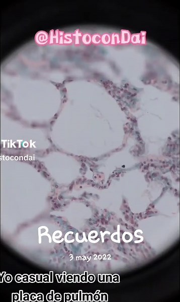 Neumocitos y el Intercambio Gaseoso en los Pulmones