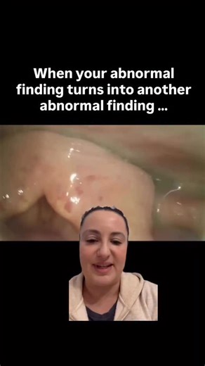 FEES competency, courses, consulting, & books for SLPs on Instagram: "Being an SLP doesn’t mean diagnosing, but it DOES mean recognizing, documenting, and communicating effectively. FEES gives us powerful information, and how we handle it matters. 🔍 First: If I see something that looks clearly abnormal and I feel strongly about it, ➡️ I recommend an additional medical consult with the appropriate provider.👃 ENT or 🧠 GI, depending on what I’m seeing. 🤔 Second: If something looks suspicious, b