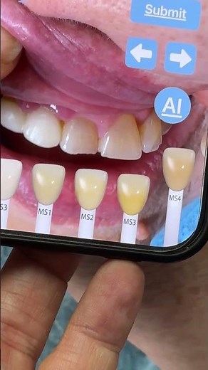 using the digital shade guide in the LSK121 App for cosmetic dentistry again in my lab today