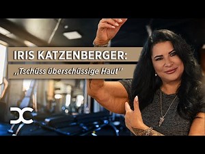 Why Iris Katzenberger had her upper arms lifted