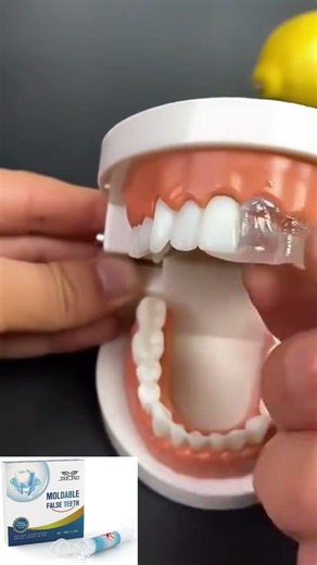 Fix the missing teeth, teeth gap, yellow teeth at home, easy, cheap, and reusable#filling#money#hole