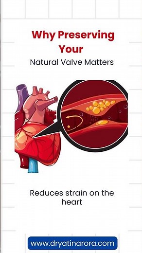 Heart Valve Surgery Explained #hearthealth