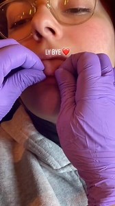 tailored snake eyes barbell 📏🎈#snakeeyespiercing #tonguepiercing #healedpiercings #piercing #mirrdopiercings #piercingrotterdam #piercingstudio | Piercing Pigs