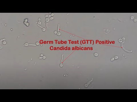 Germ tube test Positive Candida albicans Footages
