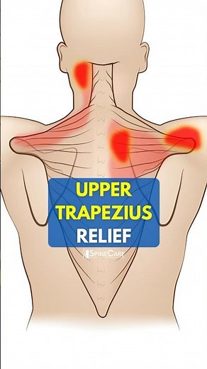 One Move for Instant Upper Trapezius Pain Relief