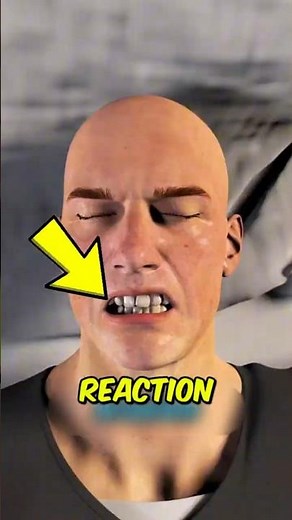 Why Teeth Grinding Is Destroying Your Teeth Without You Knowing