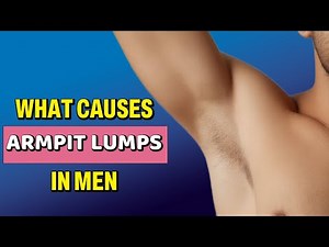 Armpit Lumps In Men | Swollen Lymph Nodes, Boils, Cysts, Infections & Cancer