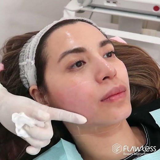 Ultherapy | The Gold Standard for non-invasive skin tightening