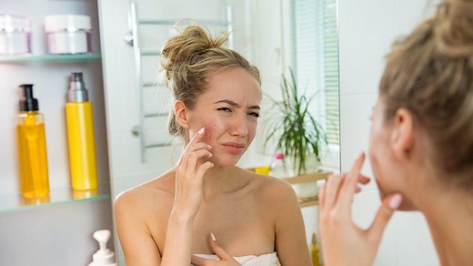 Acné chez l’adolescent : causes, conseils d’hygiène et traitements