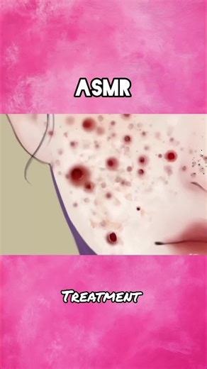 ASMR Doctor Appointment Experience for Relaxation