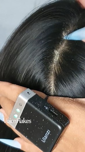 34K views · 151 reactions | Scalp Scratching So Intense You’ll Feel It, ASMR Itch Relief Sounds #Reels #ASMR #Dandrufscratching #scalpcheck #Voiceflakes | Voice Flakes | Facebook