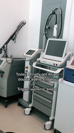 After years of wanting to get this procedure done, I finally did it! #doubleeyelidsurgery #asianeyes #plasticsurgery #blepharoplasty #MACscaraface