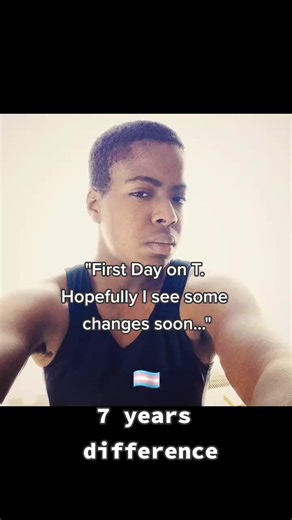 Time is your best friend. #transguy #transmasc #ftm #transformation #fypシ #follow #queertiktok #lgbt🌈 #Transgender #glowup #transandproud #ftmtrans