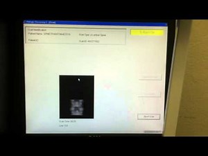 Refurbished Hologic Discovery C: Test the Condition of the Tube