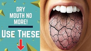 Best Dry Mouth Products 2024: Top Rated & Reviewed - Mouth Ninja