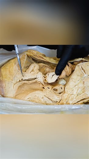 Institute of Human Anatomy on Instagram: "Female Erections Part 2 - The G-Spot Part 1 - Follow for More! In this video, Jonathan from the Institute of Human Anatomy discusses female reproductive anatomy, female erections, as well as the G-Spot. We'll discuss what the G-Spot is, where it's located, and how it is thought to relate to female climax. We’ll also review what scientific studies say about the G-Spot, addressing the debate on whether it truly exists."