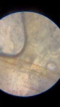 Insect Under the Microscope: A Fascinating Close-Up View