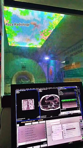 Inside MRI Control Room | Radiology Technology Explained 😍 #MRI #Radiology #Hospital #reels #Viral