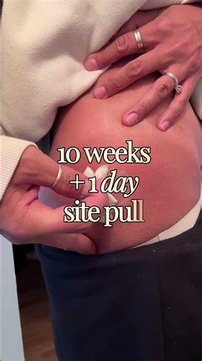 Longest site ever vs old longest site ever #subcutaneousremodulin