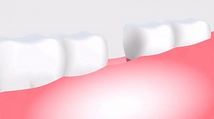 Human Tooth Anatomy Animation Background Stock Footage Video (100% Royalty-free) 3475133857 | Shutterstock