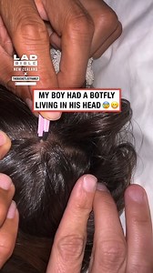 My son had a bot fly in his head 😰 | LADbible New Zealand