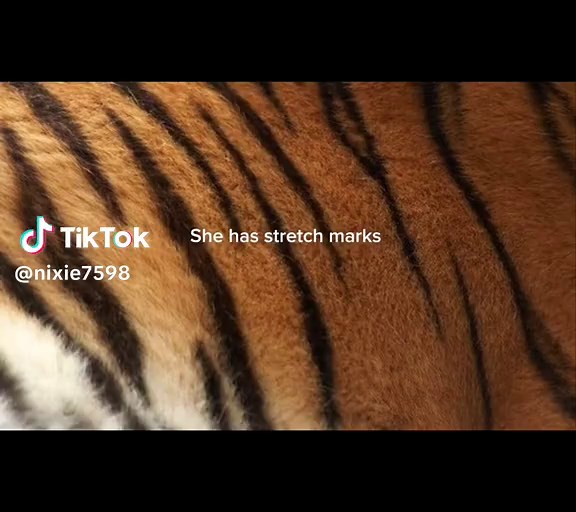 Embrace Your Beauty: Stretch Marks and Self-Love