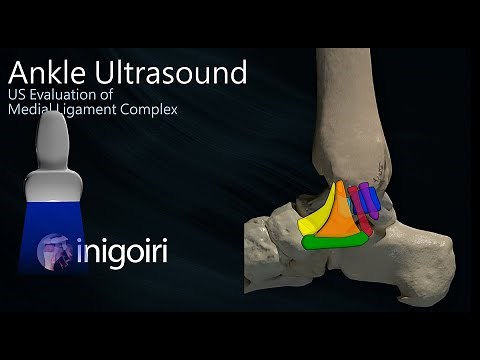 ANKLE ULTRASOUND | Medial Ligament Complex & Spring Ligament Evaluation
