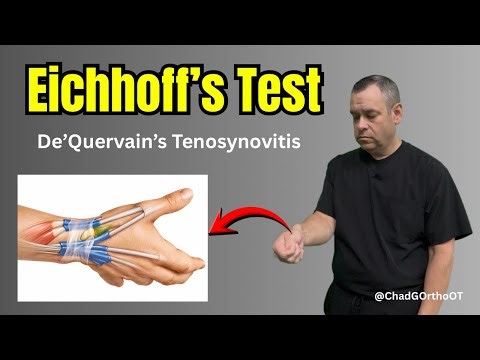Eichhoff’s Test Explained | Simple Thumb Pain Test for De Quervain’s