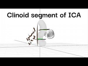 Clinoid segment ICA