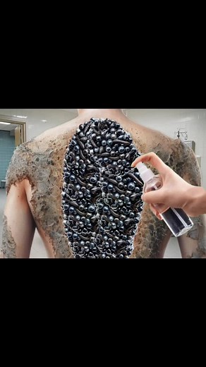 #2dasmr #fyp #asmrsurgeon #asmrhospital #maggot #asmrsurgery #2danimation #asmr #asmrusa #fyp