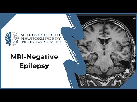MRI-Negative Epilepsy