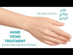 HAND VEINS REMOVAL