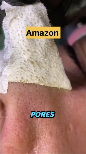 Blackhead Removal Strips| Pore Strips That Actually Work! 🔥 Real Results”
