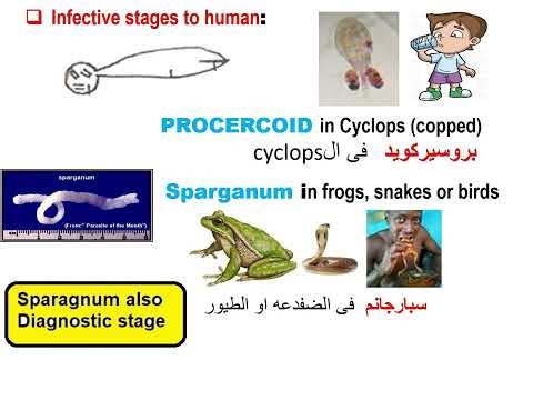 Parasitology CNS module Sparganosis 20266