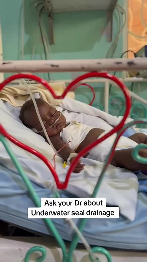 Underwater Seal Drainage Explained by Nurses