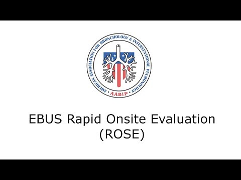 EBUS Rapid Onsite Evaluation (ROSE)
