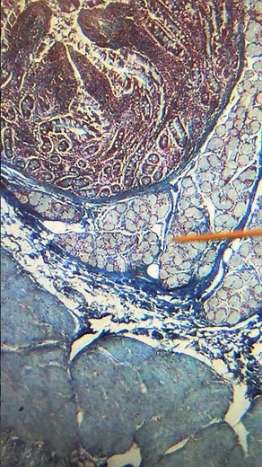 Histology of the Duodenum