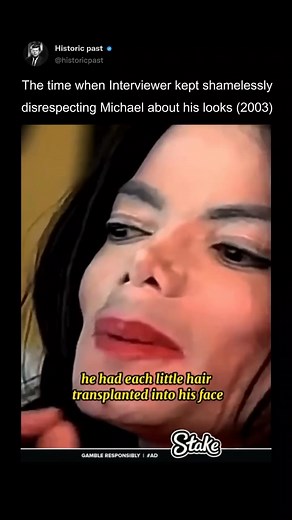 In a 2003 interview with British journalist Martin Bashir, Michael Jackson was questioned about his physical appearance, particularly his changing skin tone and facial features. Bashir asked Jackson about the controversies surrounding his skin, including rumors of plastic surgery and his diagnosis of vitiligo, a skin condition that causes depigmentation. Jackson defended himself, explaining that his lighter skin was due to the condition and not due to any intentional cosmetic changes. He also di