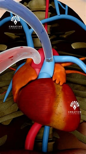 What Happens During a Heart Transplant😳