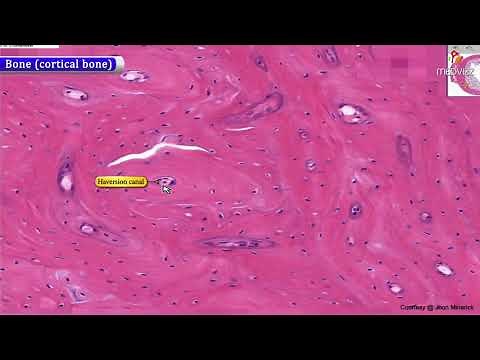 Histology of Bone (cortical bone) : Shotgun Histology