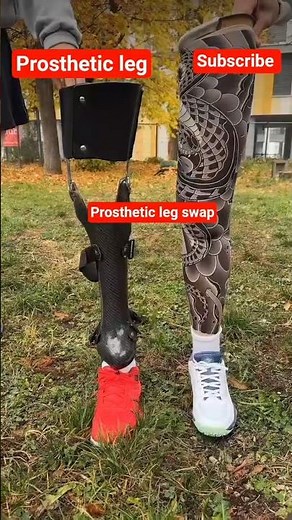 Prosthetic Leg Design for Amputees | Types, Components & Modern Technology