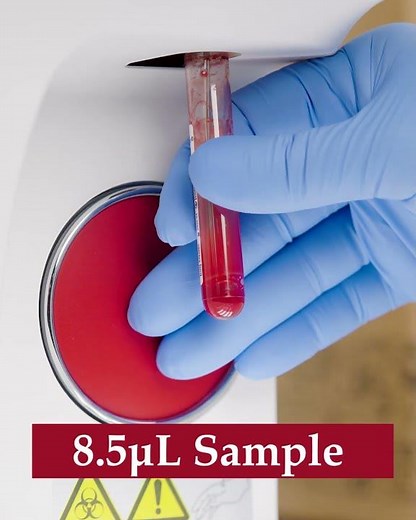 Meet the Mispa HX35 – 3-Part CBC Analyzer