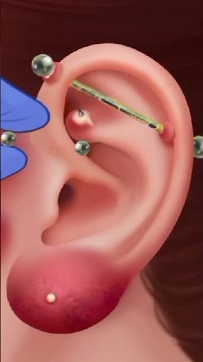 Satisfying Ear Piercing Treatment & Acne Removal ASMR #shortvideo #shorts #short #oddlysatisfying