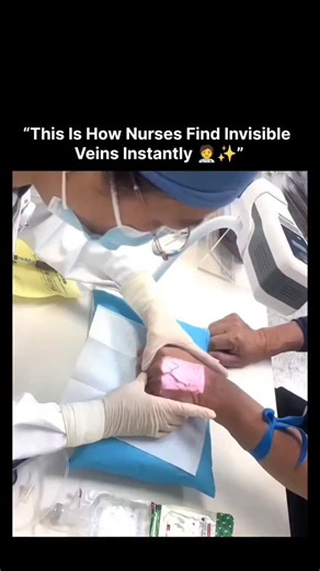 instaascience_ on Instagram: "Finding the right vein for an injection or IV can be tricky-but not with this device. It's a vein viewer, and it works by shining near-infrared light onto the skin. The light is absorbed differently by blood and surrounding tissue, allowing the machine to detect and project a live image of the veins back onto the skin. This makes procedures faster, less painful, and more accurate-especially for kids, elderly patients, or those with deep veins. Ever seen one of these
