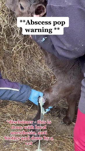 Abscess popping #abscess #abscesspop #abscesspopping #pimple #pimplepop #pimplepopping #pimplepoppingheaven #cowabscess #calfabscess #pimplepopper