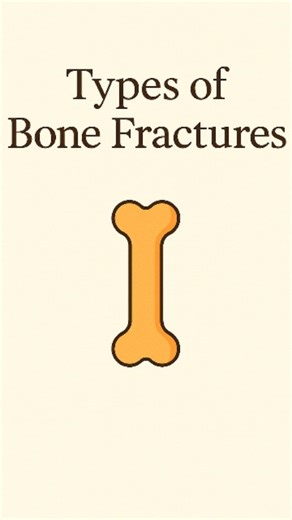Dr.Arsalan (PT) on Instagram: "Bone fractures may look similar, but each one tells a different story. 🦴 #BoneFracture #Orthopedics #Physiotherapy #BoneHealth #FractureTypes #MedicalEducation #PTStudents #HealingJourney #OrthoCare #DrArsalanPT #HealthAwareness #InjuryPrevention #RehabMedicine #PhysioKnowledge"